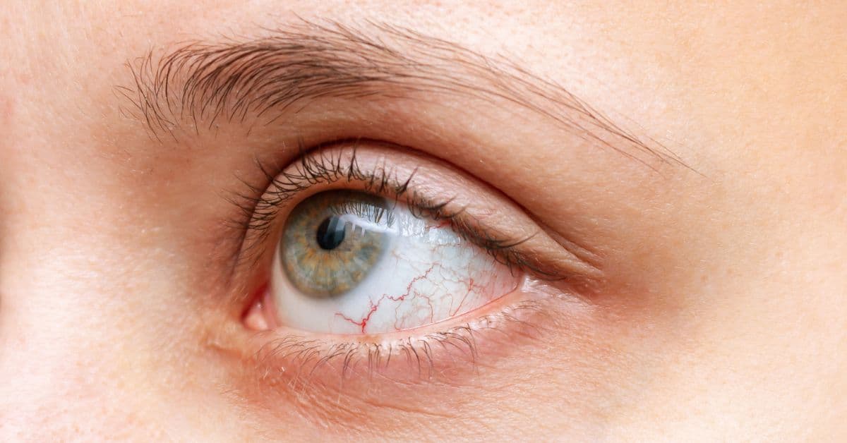 ie (Reklama na Facebooka) (35)